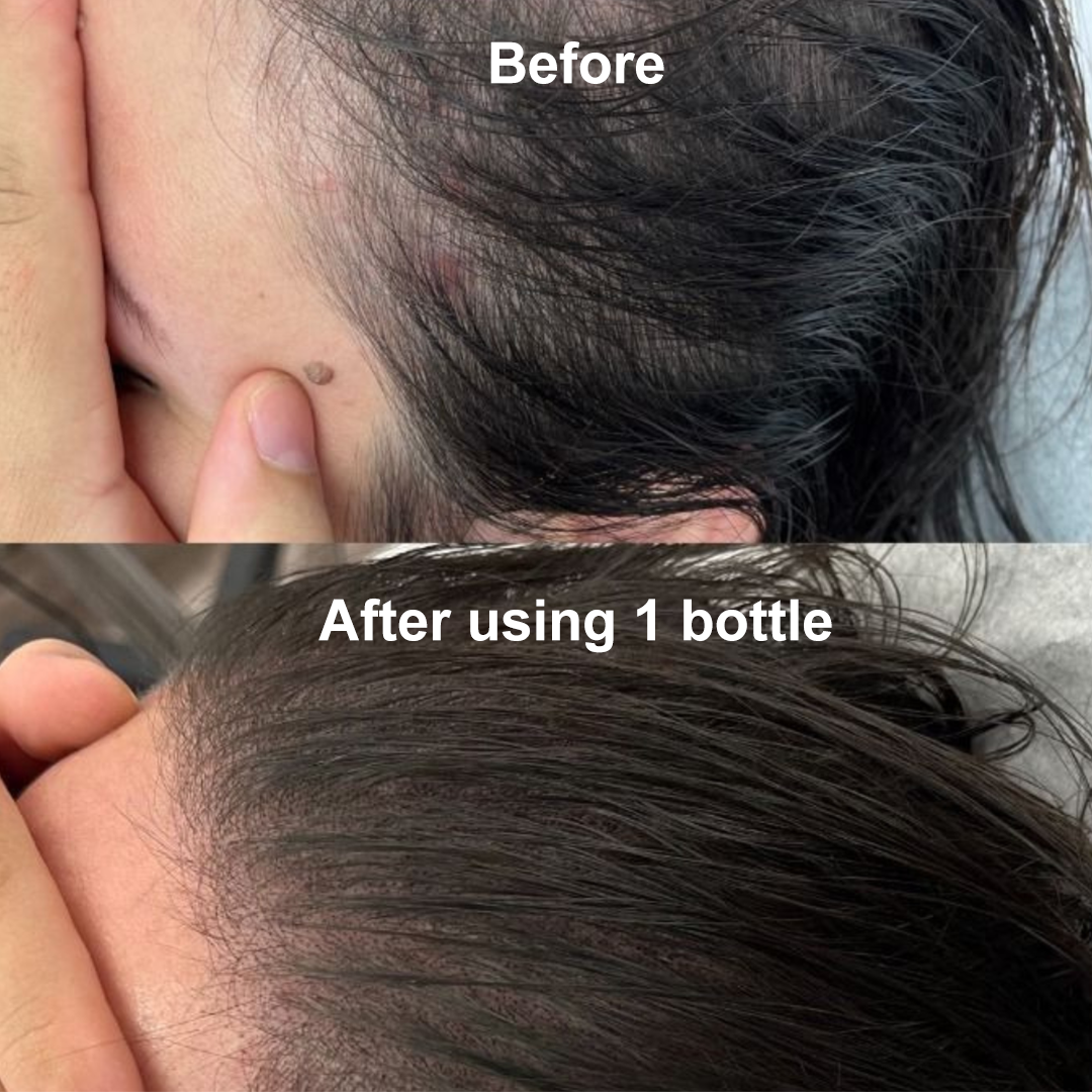 Elvera Heritage Hair Oil - 150ml